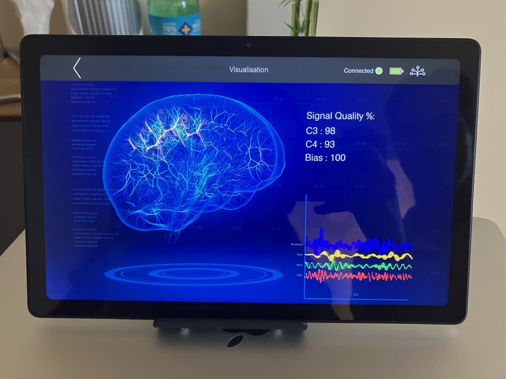 image of axon software in use