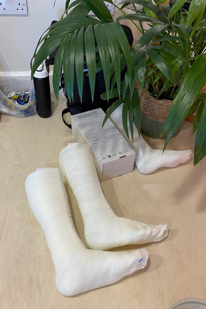 orthotics cast